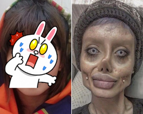 塔瓦爾整容前的照片(左)。