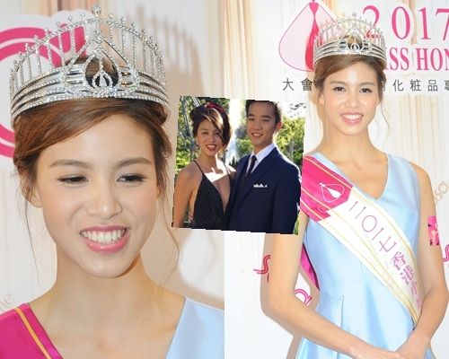 雷莊𠒇自信十足,獲牙醫男友力撐唔使做手術。