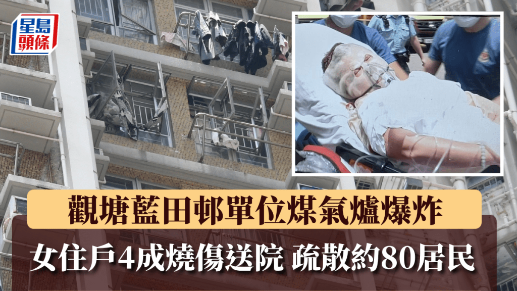 觀塘藍田邨單位煤氣爐蒸蕃薯時爆炸 女住戶4成燒傷送院