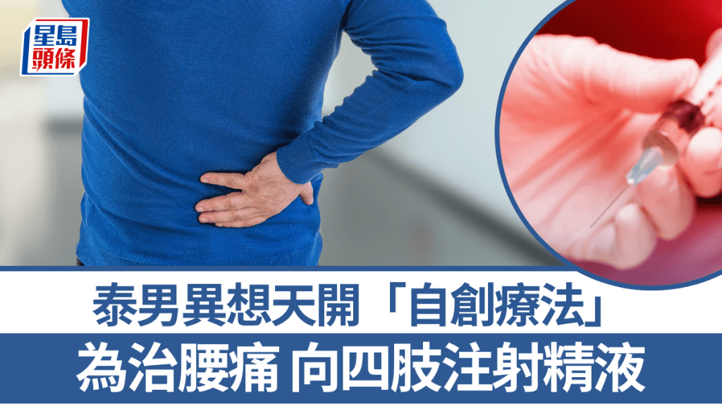 奇男自創「精子療法」治腰痛。 法新社示意圖