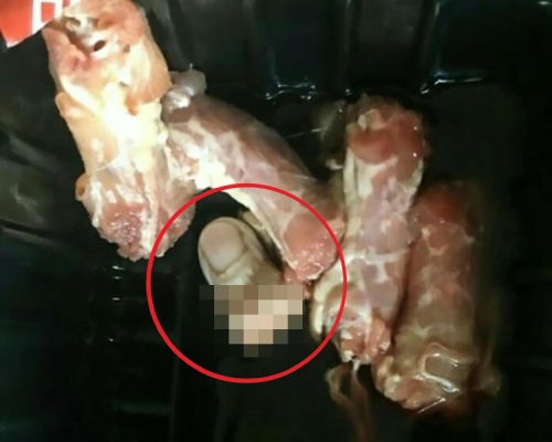 手指的主人是肉類加工廠的員工。網圖