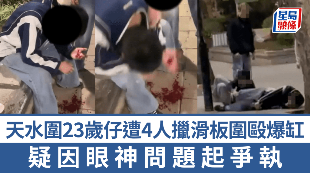 天水圍23歲仔遭4人擸滑板圍毆爆缸 疑因眼神問題起爭執