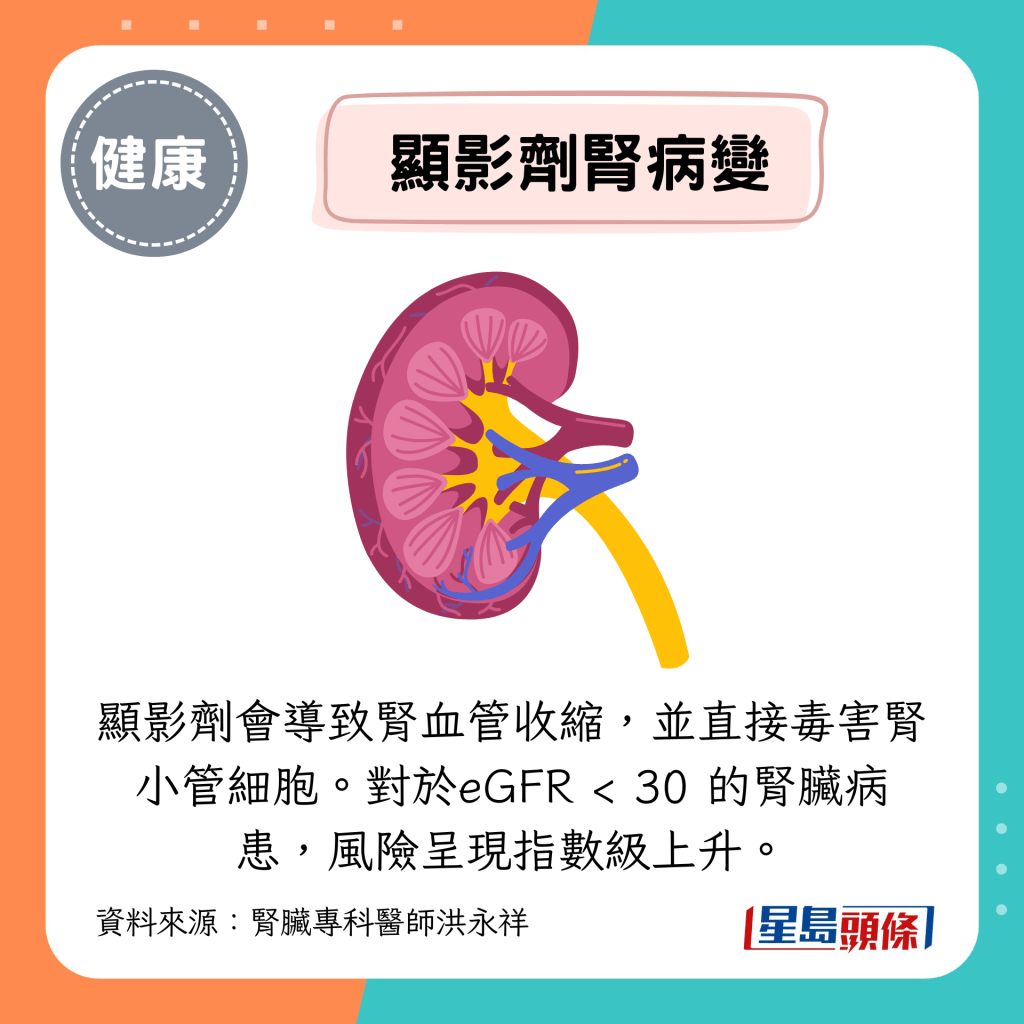 显影剂会导致肾血管收缩,并直接毒害肾小管细胞。对于eGFR < 30 的肾脏病患,风险呈现指数级上升。 显影剂会导致肾血管收缩,并直接毒害肾小管细胞。对于eGFR < 30 的肾脏病患,风险呈现指数级上升。
