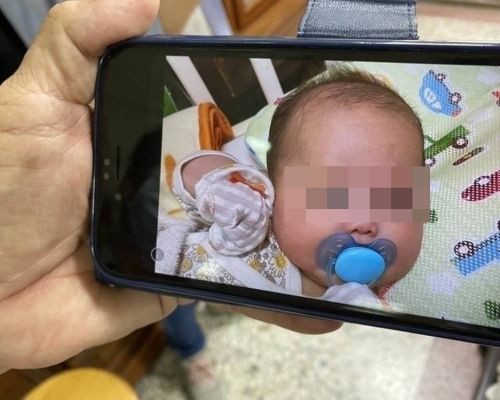 台灣當局解剖檢驗指，母親打針後餵母乳猝死的女嬰，有呼吸道感染。網圖