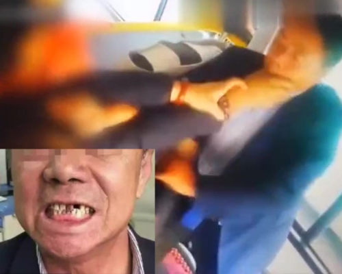 陝西三乘客欲前門下車遭拒,圍毆巴士司機,司機門牙也被打脫落。(網圖)