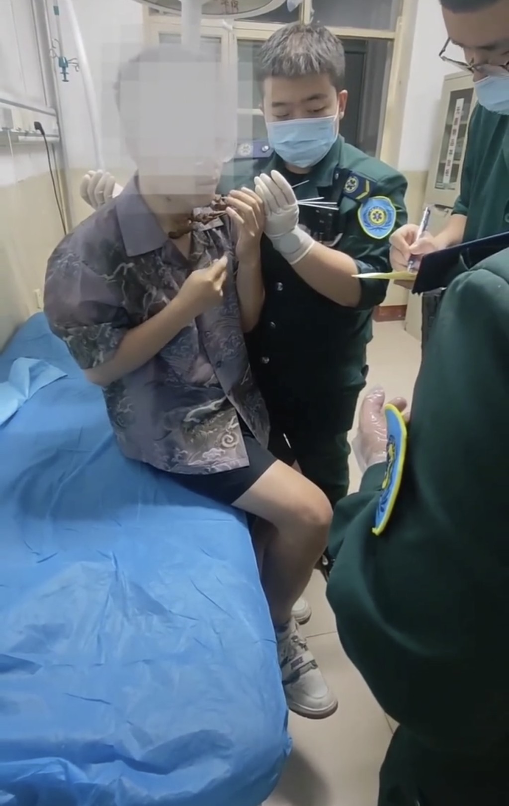 山西男子頸部被扎多根燒烤籤。微博@說好的8972 山西男子頸部被扎多根燒烤籤。微博@說好的8972