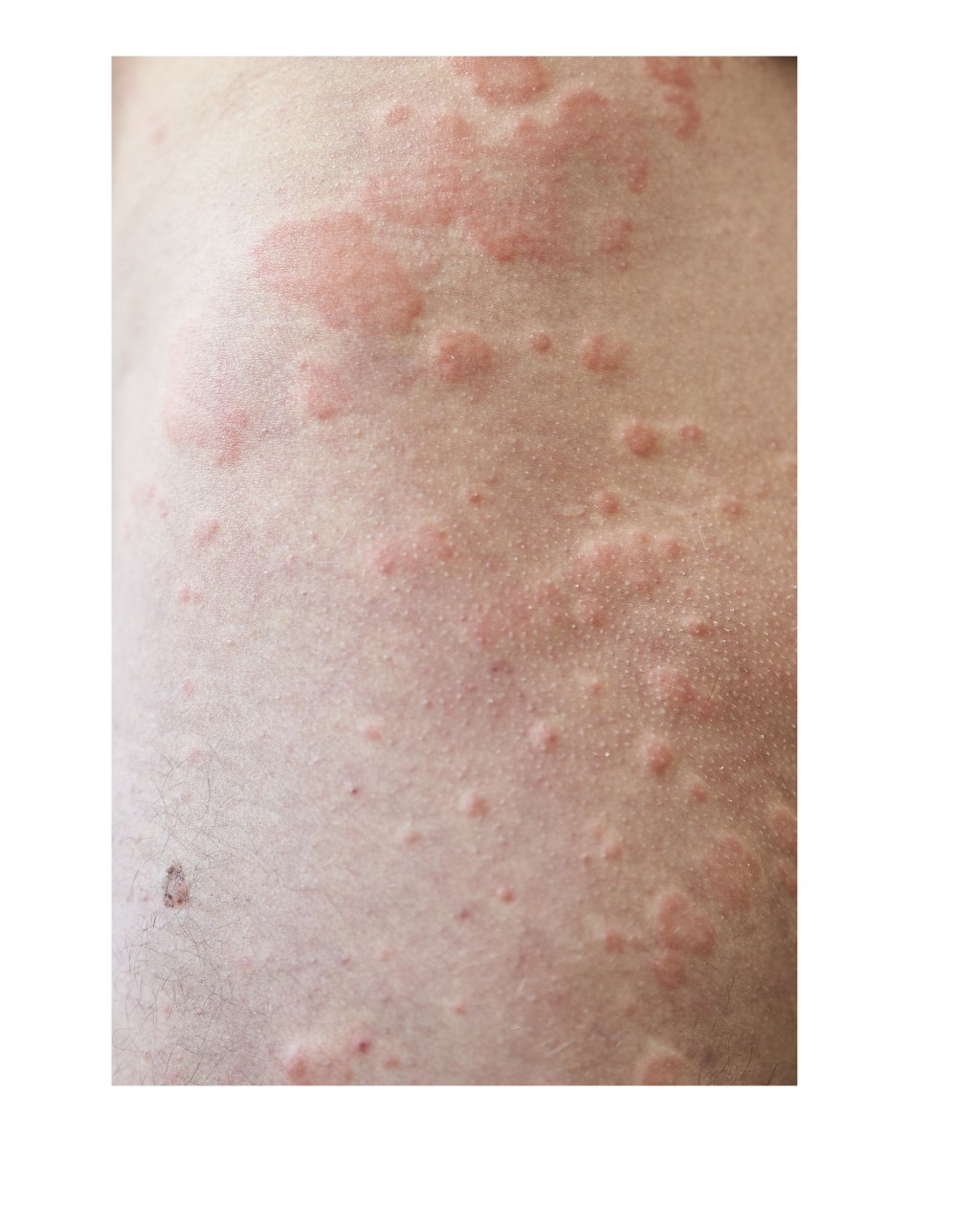 (參考圖片/圖片來源:受訪者提供) (參考圖片/圖片來源:受訪者提供)