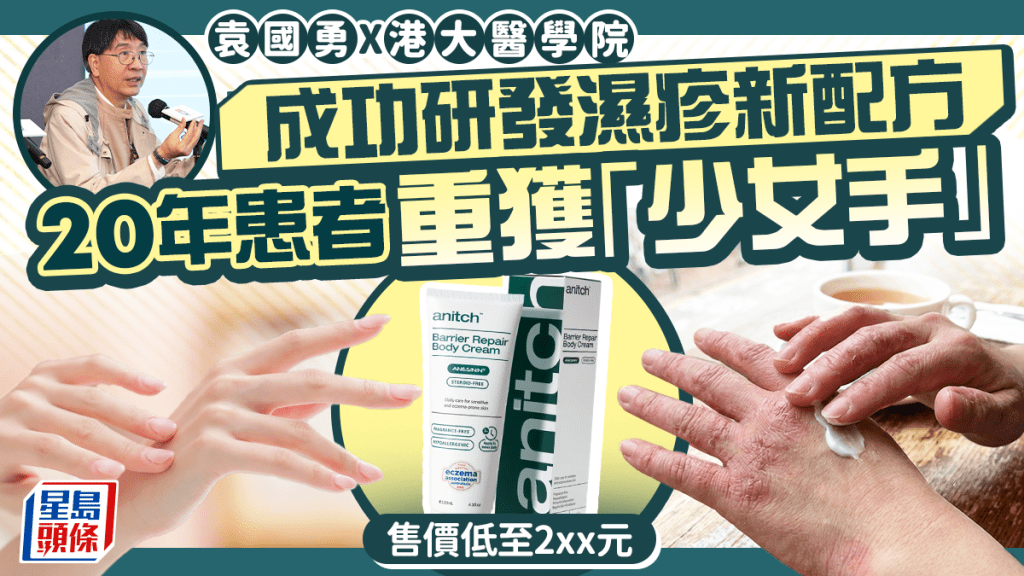 袁國勇偕港大醫學院成功研發濕疹新配方 20年患者重獲「少女手」新藥售價低至2xx元