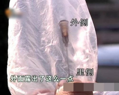 俞女士自行拔出的针头。 网上图片