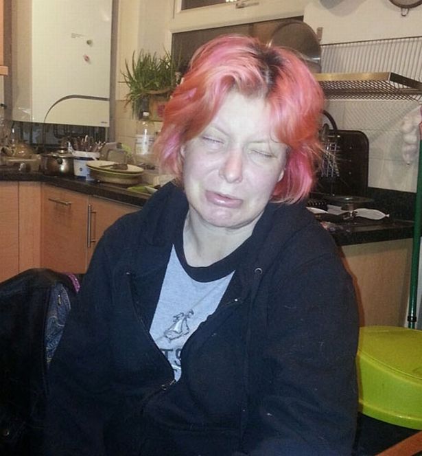 英國婦人沃爾沃克(Cate Wallwork)自17歲起無笑過。網上圖片