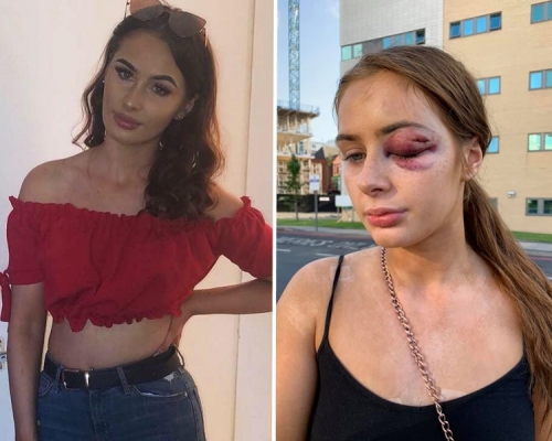 這場意外造成Gabrielle的陰影,讓她不敢一個人外出。 Gabrielle Walsh FB圖片/Alliyah Morgan FB圖片