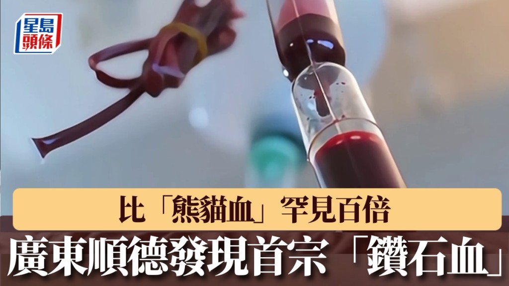 廣東順德發現首宗「鑽石血」，比「熊貓血」罕見百倍。
