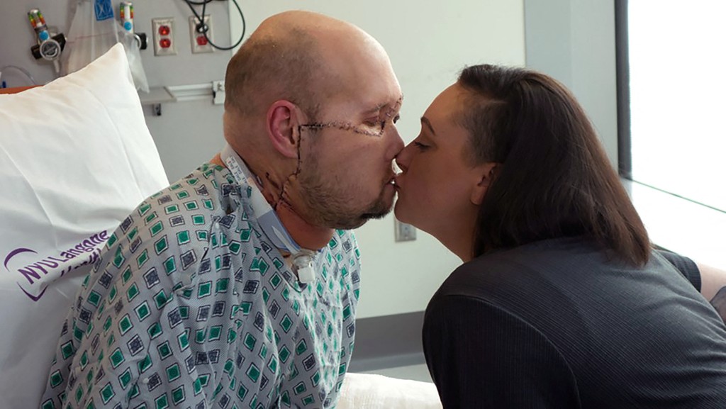 詹姆斯接受手術後首次親吻妻子。路透社