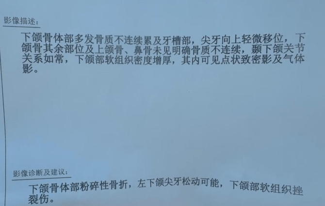 北京男子駕車行駛時遭飛石「突襲」。小紅書@大灰灰 北京男子駕車行駛時遭飛石「突襲」。小紅書@大灰灰
