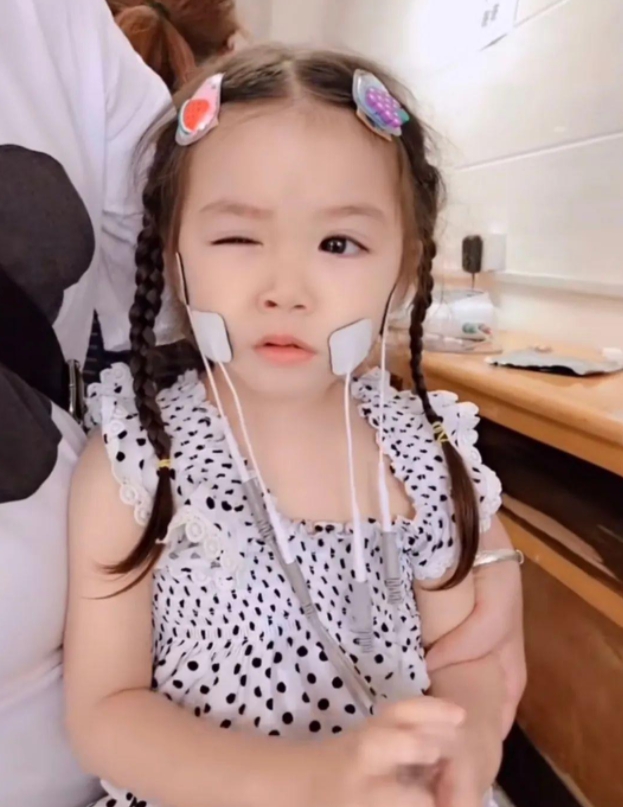 妮妮6個月大起發育較同齡孩子慢，經檢查後發現患有此罕見基因病。網圖