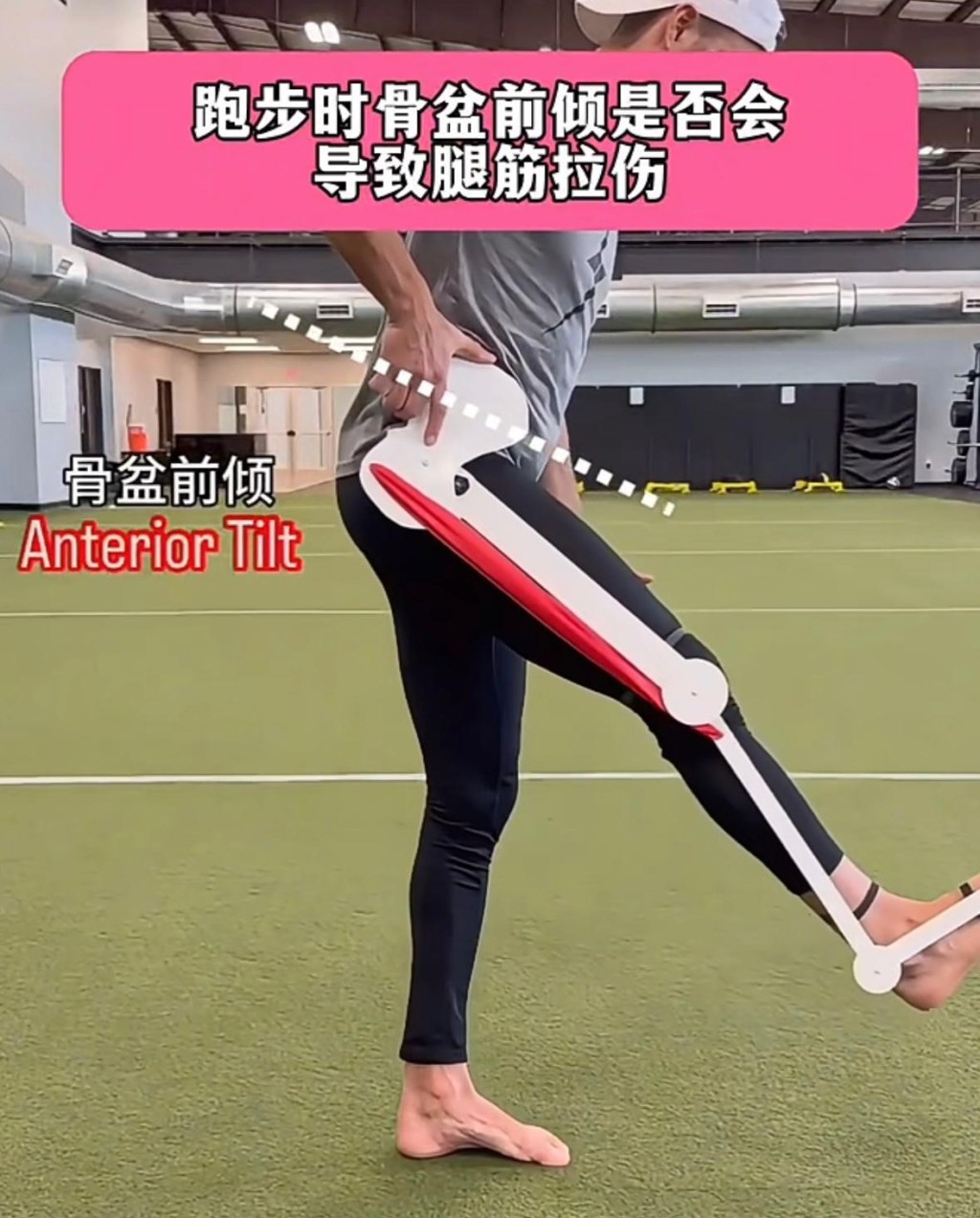 跑步時骨盆前傾會導致容易拉傷。圖片由筆者提供 跑步時骨盆前傾會導致容易拉傷。圖片由筆者提供