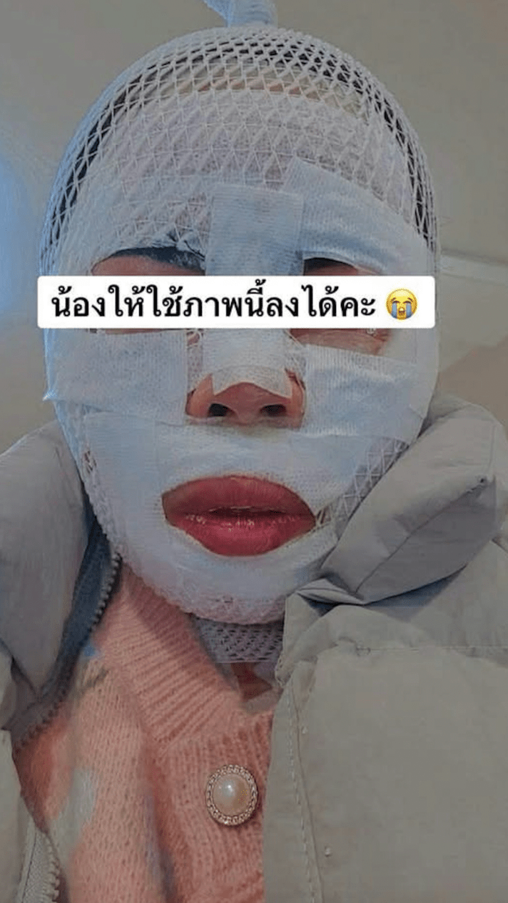 受害女子事後在社交媒體上發文求助，上傳了自己整張臉包滿繃帶的照片，表示自己受到丈夫的家暴與毀容威脅。Facebook@NNutt AAomsin