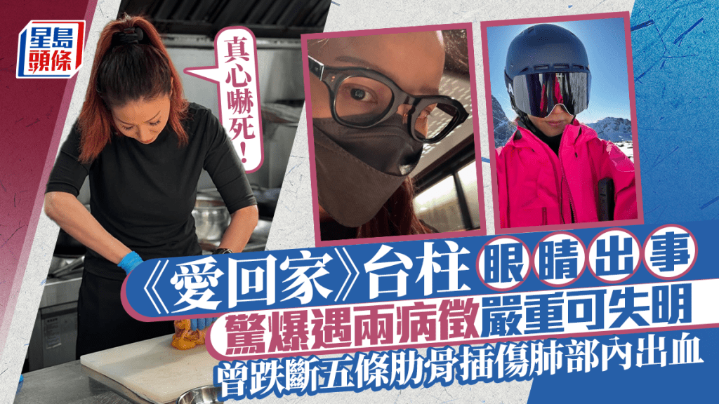 《愛回家》台柱驚爆眼睛出事！遇兩病徵嚴重可失明：真心嚇死  曾跌斷五條肋骨插傷肺部內出血