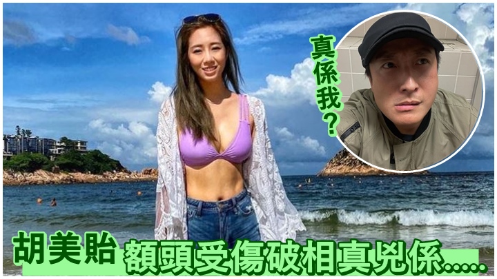 胡美貽日前撞傷額頭，今日有指「真兇」是方力申。