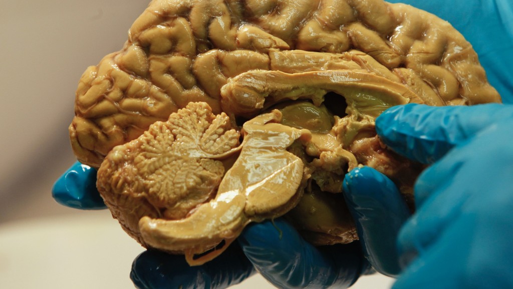 史丹福大學最新研究發現，人類大腦前部和後部基本上是兩個器官，祖細胞完全不同。 路透社示意圖
