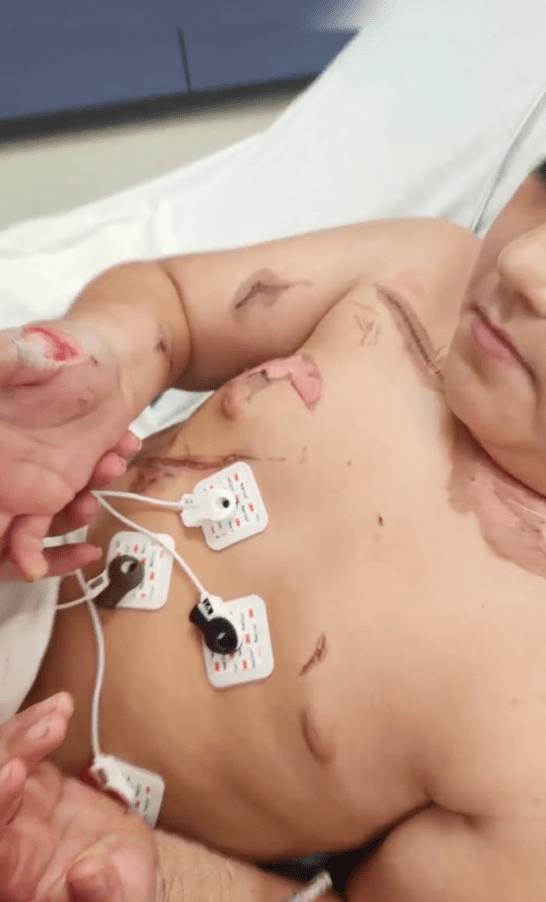 Lorenzo Lopez身上被電流灼傷的疤痕令人悚目驚心。