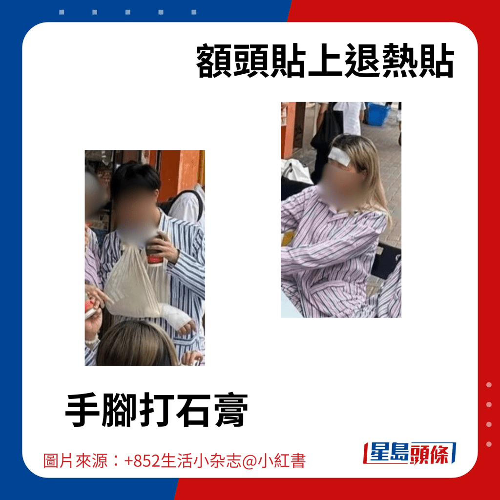 包括手腳打石膏、額頭貼上退熱貼