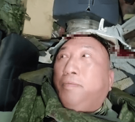 鳳凰衛視戰地記者盧宇光頭部受傷。 微博 鳳凰衛視戰地記者盧宇光頭部受傷。 微博