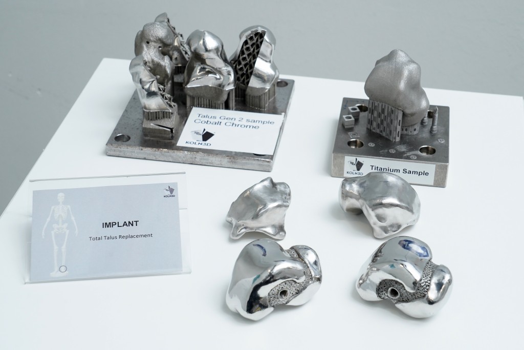 团队首个3D金属医疗打印便是足踝骨，经过多次改良后，制作出最完善的产品。