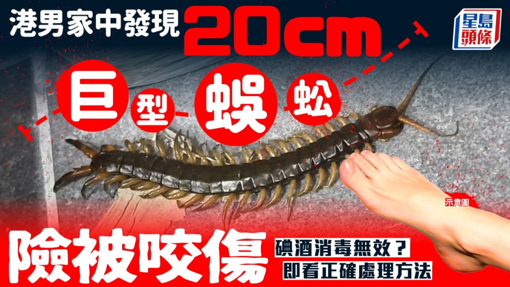 港男家中发现20cm蜈蚣险被咬伤 用碘酒消毒原来无效 即看咬伤正确处理