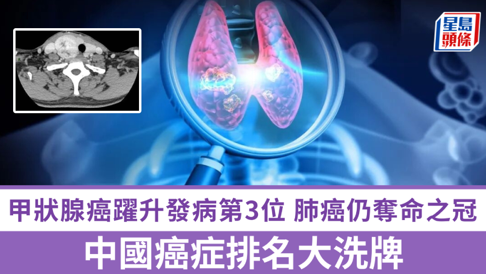 中国癌症排名大洗牌，甲状腺癌跃升发病第3位，肺癌仍夺命之冠。