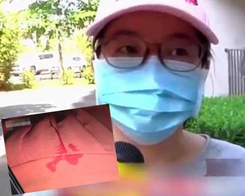 女子在小區樓下倒垃圾時,突然被從天而降的口水濺中。網圖