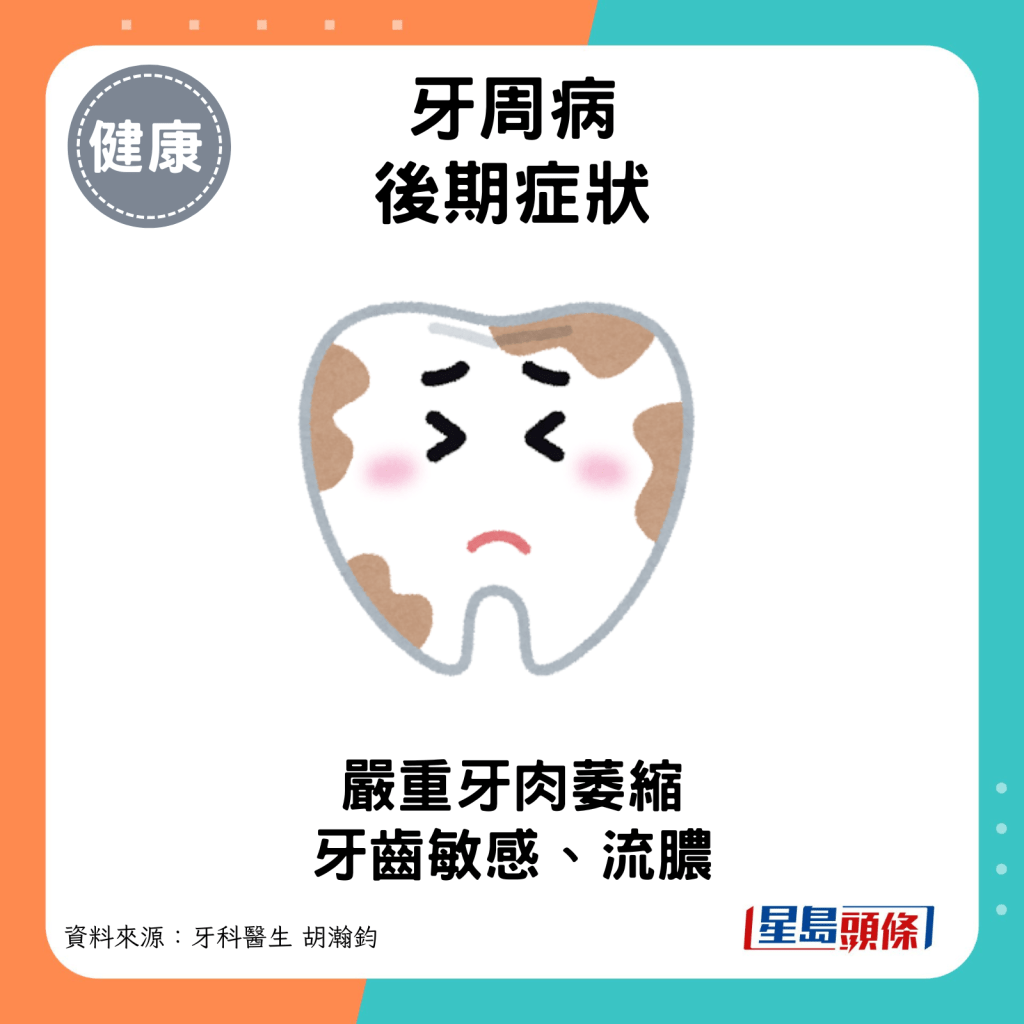 牙周病後期症狀：嚴重牙肉萎縮。
