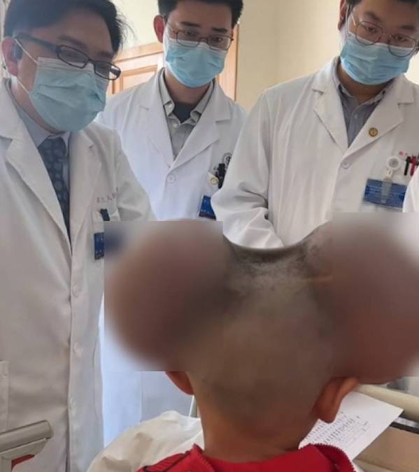琪寶為切除頭上巨痣,要在頭頂兩側注水,被人嘲笑是「米奇老鼠」。抖音@美俠小頭 琪寶為切除頭上巨痣,要在頭頂兩側注水,被人嘲笑是「米奇老鼠」。抖音@美俠小頭