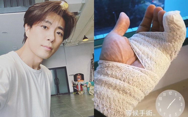 張景淳昨日開工被狗咬傷送院。