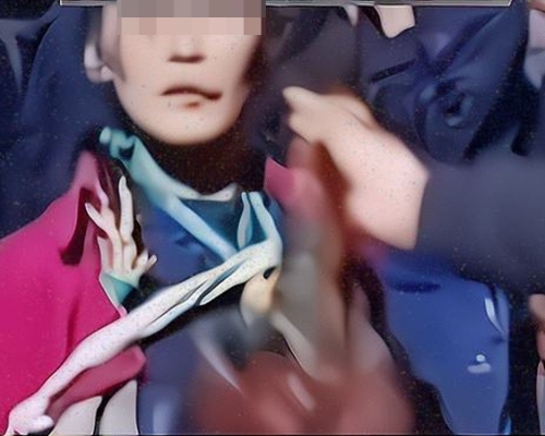 雲南偷雞女賊被抓遭私刑，村民活雞塞嘴巴。