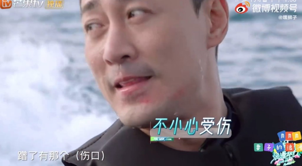 林峯仲整傷下巴！