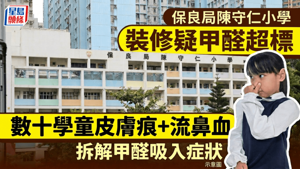 保良局陈守仁小学疑甲醛超标 数十学童皮肤痕+流鼻血 教育局称工程物料合格｜附甲醛吸入症状
