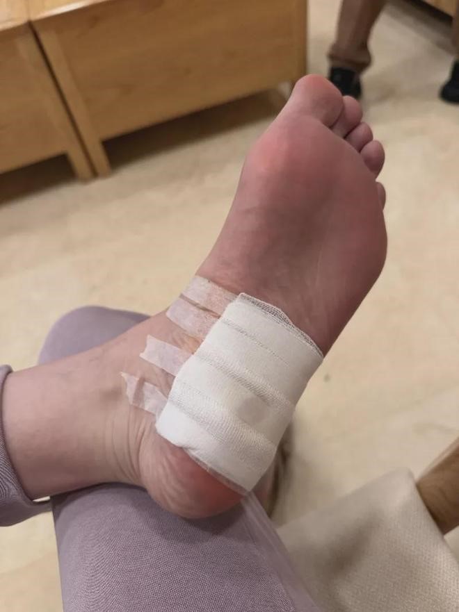 陈女士在福田口岸附近的网红水疗店踩钉受伤。奥一新闻 陈女士在福田口岸附近的网红水疗店踩钉受伤。奥一新闻