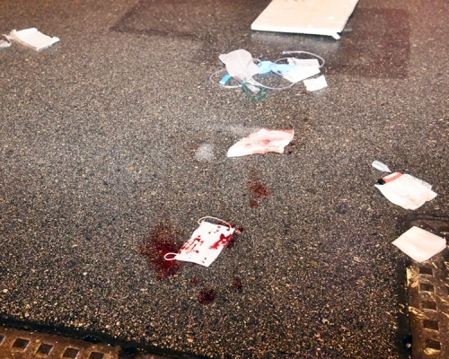現場遺下血跡和染血口罩等雜物。