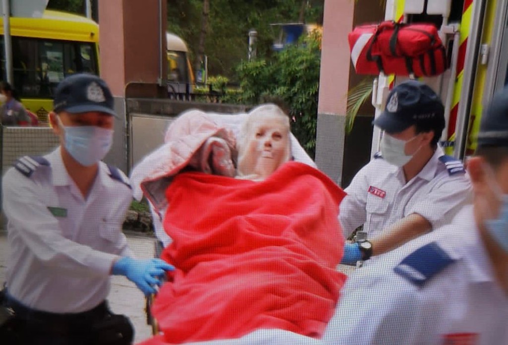 75岁女顾客烧伤面部送院。