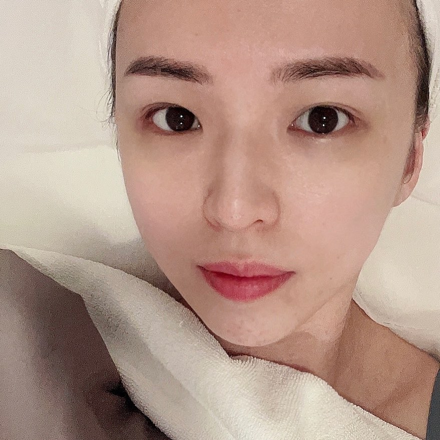 阿雪笑言減肥後出現皺紋。