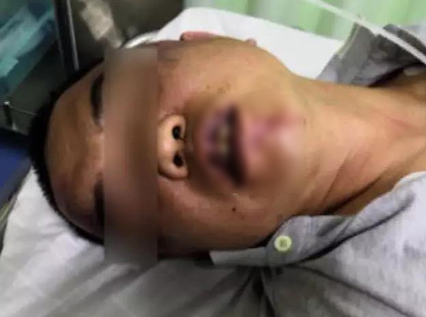 楊女一名長輩頭部受傷，正在接受治療。　網上圖片