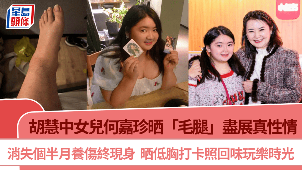 胡慧中女兒何嘉珍晒「毛腿」盡展真性情  消失個半月養傷終現身  晒低胸打卡照回味玩樂時光