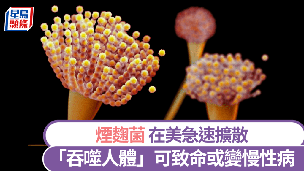 「吞噬人體」煙麴菌美國爆疫。 法新社