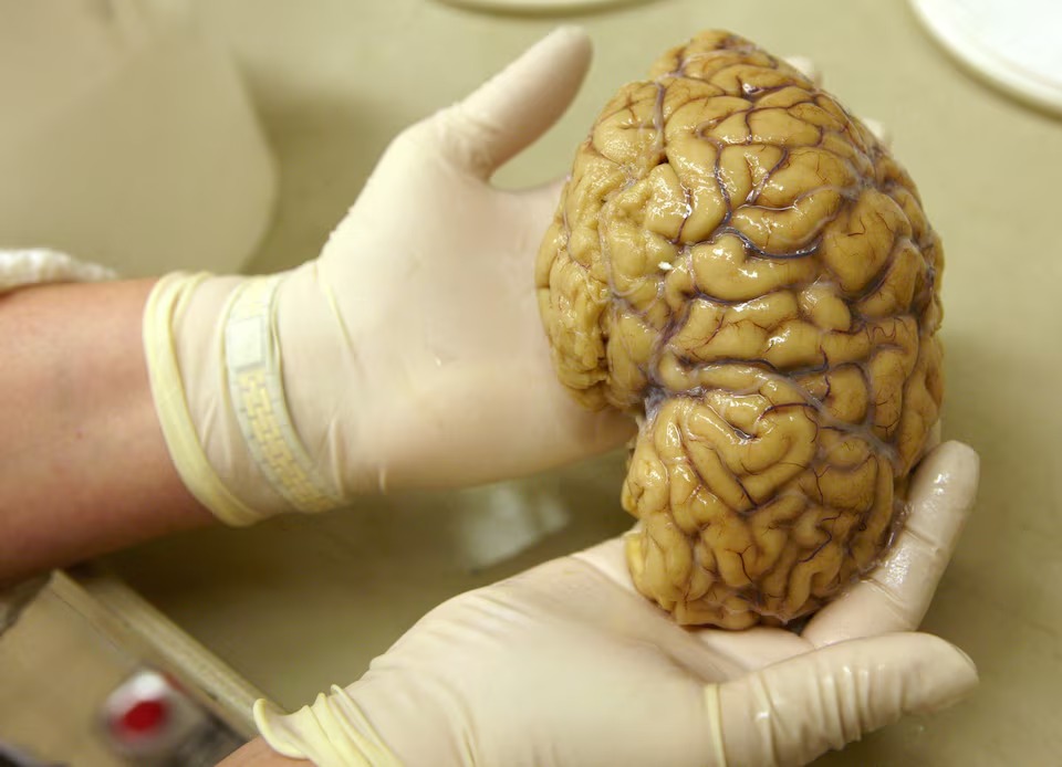 人脑过去数十年平均尺寸增大。路透社