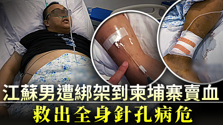 江蘇男墮求職陷阱遭綁架海外半年淪供血工具。網上圖片