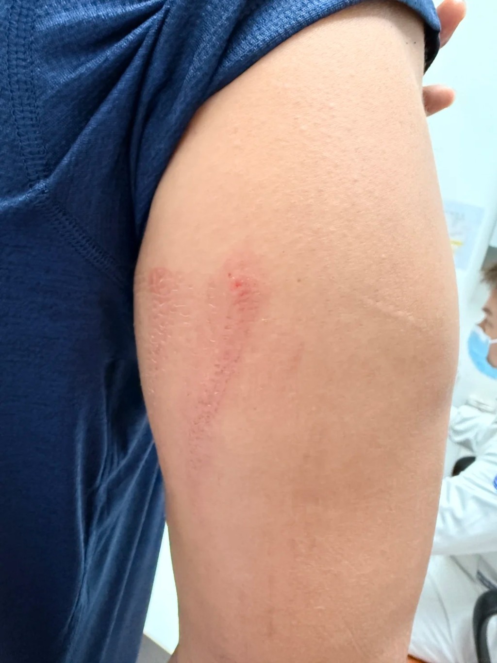 楊先生及女兒身體多處擦傷。 楊先生及女兒身體多處擦傷。