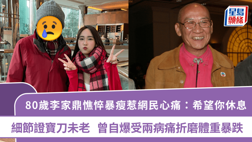 80歲李家鼎憔悴暴瘦惹網民心痛：希望你休息  細節證寶刀未老  曾自爆受兩病痛折磨體重暴跌