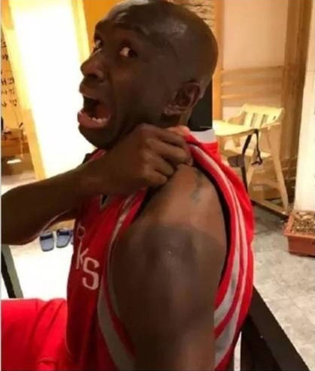 黑色皮膚的姆比亞拉起袖子,展示自己肩部一條清晰的深黑淺黑色分界線。網圖