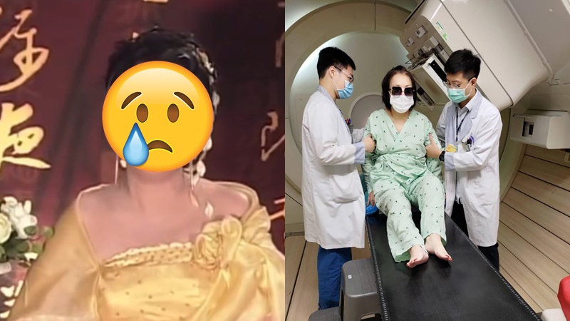 75歲殿堂女星癌症復發  惡疾苦纏14年先後切去雙乳  接受放射治療廿次：死了算了